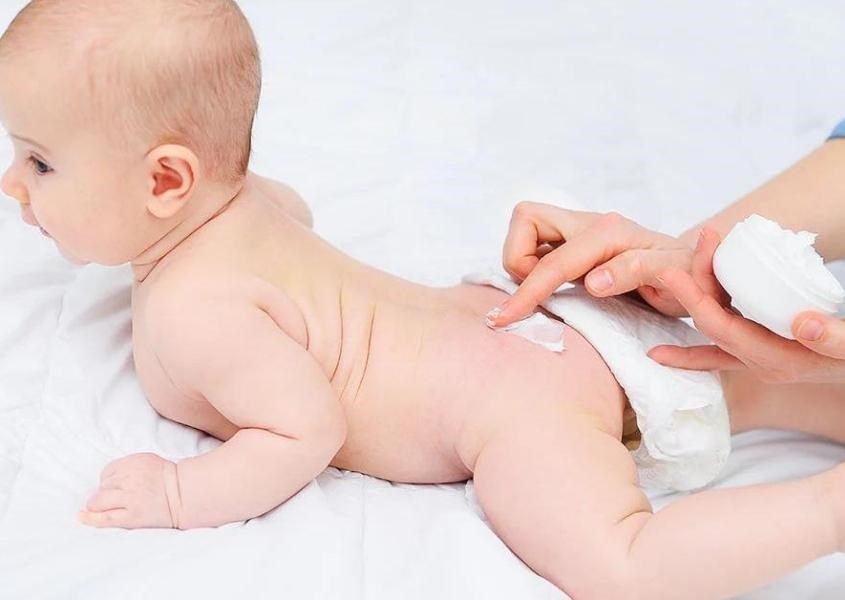 Sử dụng kem chống hăm cho bé