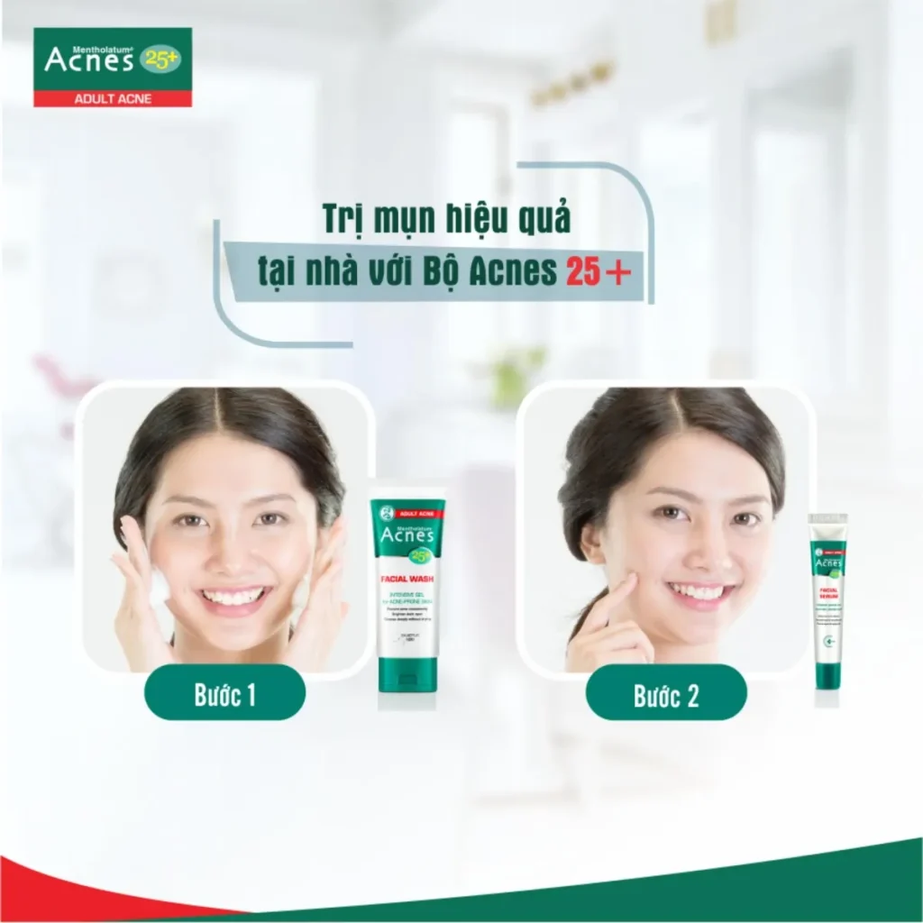 Serum Acnes 25+ Facial Serum 20ml Giảm Mụn Mờ Thâm 3 Serum Acnes 25+ Facial Serum 20ml Giảm Mụn Mờ Thâm - Ảnh 3