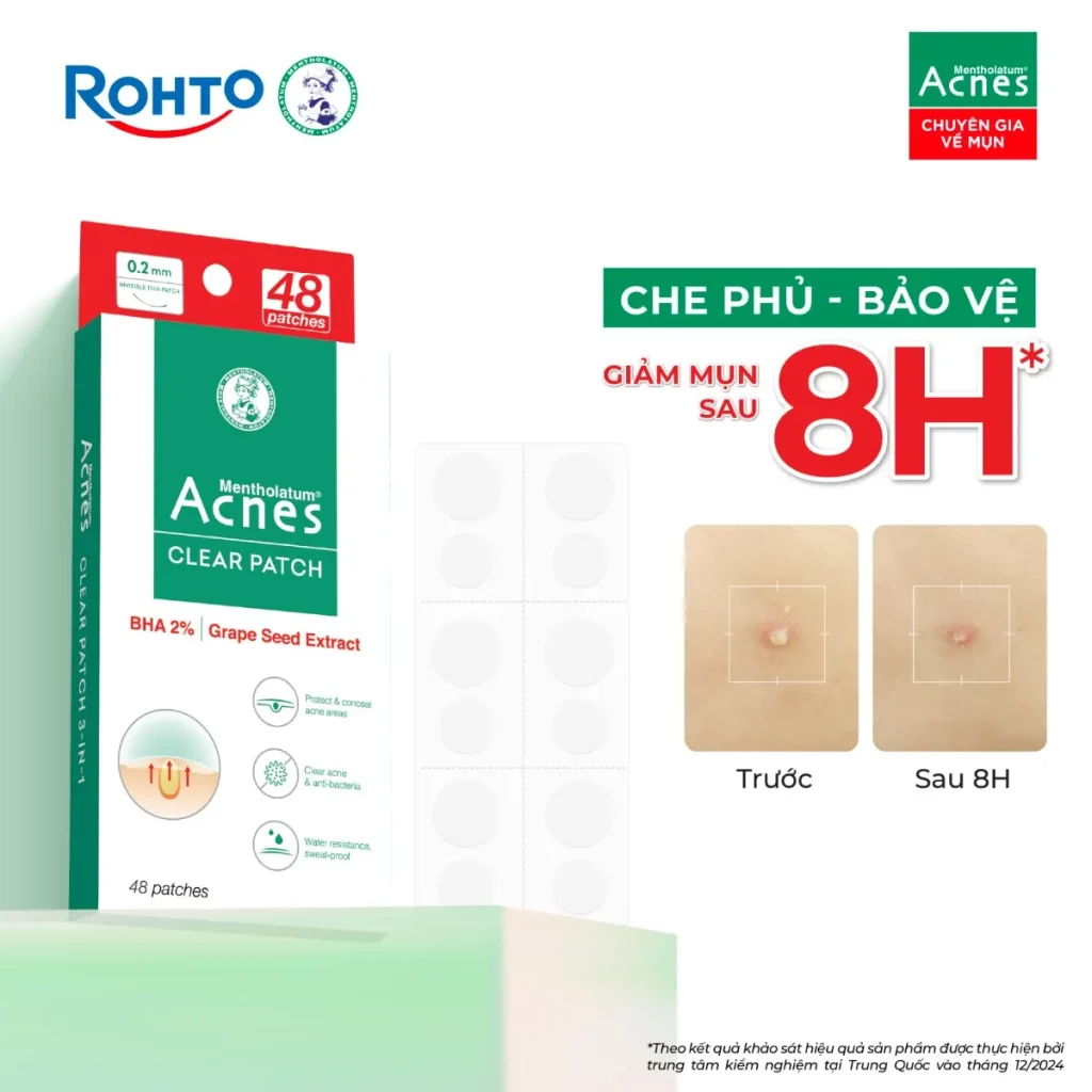 Miếng Dán Mụn Acnes Clear Patch Bảo Vệ Nốt Mụn 48 Miếng 4 Miếng Dán Mụn Acnes Clear Patch Bảo Vệ Nốt Mụn 48 Miếng - Ảnh 4