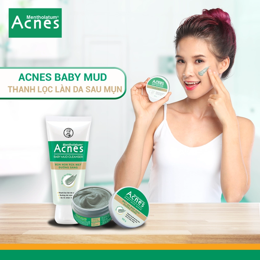 Mặt Nạ Acnes Bùn Non Dưỡng Sáng Da Giảm Mụn 100g 3 Mặt Nạ Acnes Bùn Non Dưỡng Sáng Da Giảm Mụn 100g - Ảnh 3