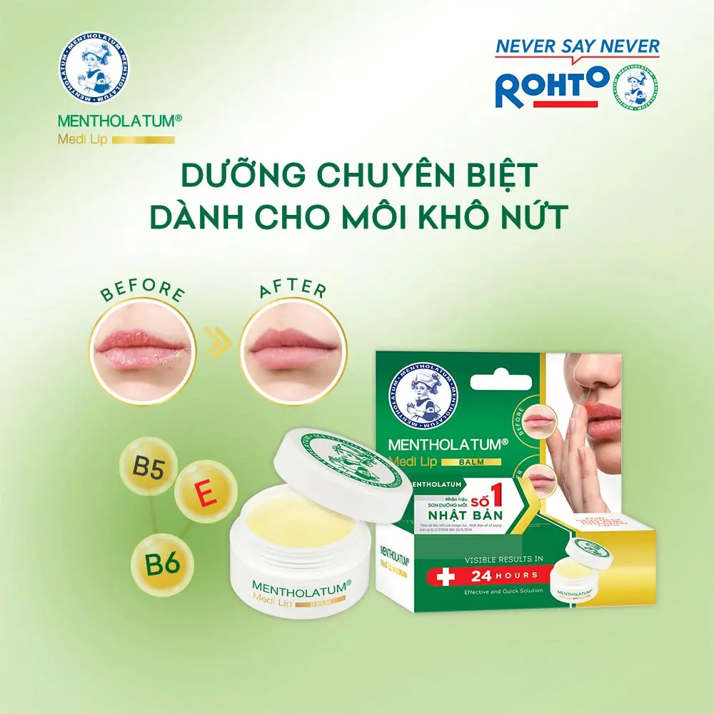 Sáp Dưỡng Môi Medi Lip Balm 7g Dưỡng Ẩm Môi Khô Nứt Nẻ 3 Sáp Dưỡng Môi Medi Lip Balm 7g Dưỡng Ẩm Môi Khô Nứt Nẻ - Ảnh 3