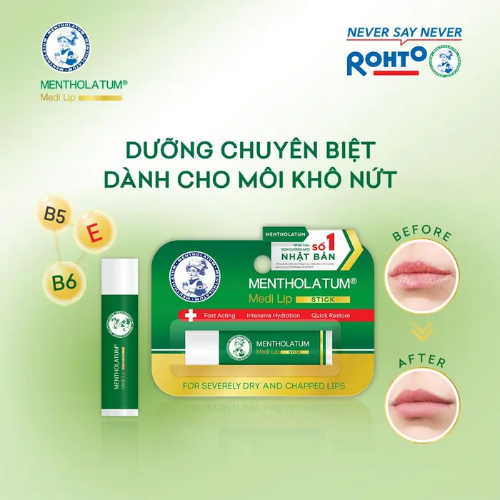 Sáp Dưỡng Môi Rohto Medi Lip Balm 4.3g Giảm Khô Nứt Nẻ 3 Sáp Dưỡng Môi Rohto Medi Lip Balm 4.3g Giảm Khô Nứt Nẻ - Ảnh 3