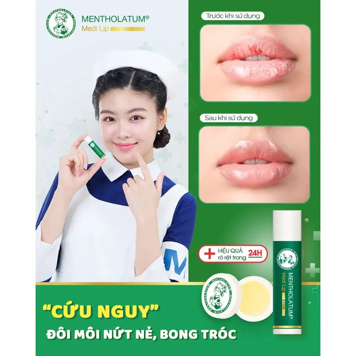 Son Dưỡng Medi Lip Stick 4.3g Dưỡng Ẩm Môi Khô Nứt Nẻ 3 Son Dưỡng Medi Lip Stick 4.3g Dưỡng Ẩm Môi Khô Nứt Nẻ - Ảnh 3